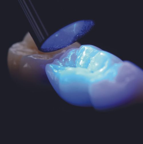 Dentisteria Operatória